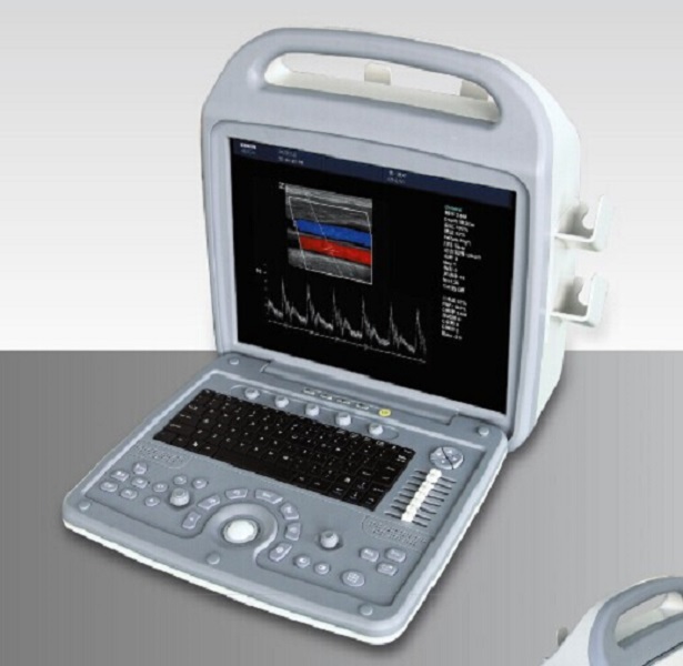 CE/ISO-zugelassene medizinische Farbdoppler-Ultraschalldiagnosesystem-Maschine (MT01006032)
