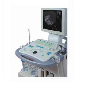 CE/ISO-zugelassene Gyn Visible Ultraschall-Diagnosesystem-Maschine (MT01006081)