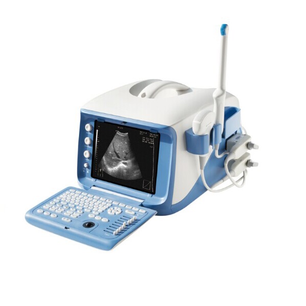 Tragbare 4D-Ultraschalldiagnosesystemmaschine des Krankenhauses (MT01006101)